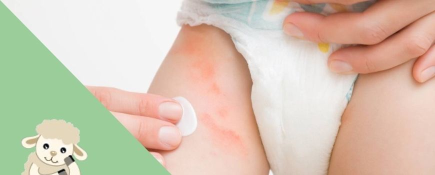 Couches bébés, peau sensible et rougeurs: comment en finir?